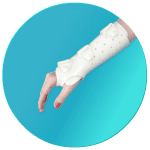 Kaki Palsu Makassar – Tangan Palsu Makassar – Hubungi 085394849766 Cock Up Splint