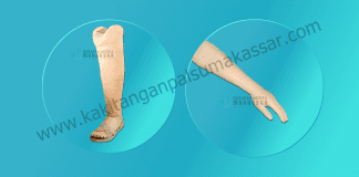 Jenis – Jenis Kaki Palsu dan Tangan Palsu Kaki Palsu Makassar - Tangan Palsu Makassar - Hubungi 085394849766