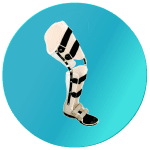 Kaki Palsu Makassar – Tangan Palsu Makassar – Hubungi 085394849766 Knee Ankle Foot Orthosis