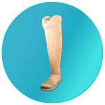 Kaki Palsu Makassar – Tangan Palsu Makassar – Hubungi 085394849766 Kaki Palsu Makassar - Tangan Palsu Makassar - Hubungi 085394849766