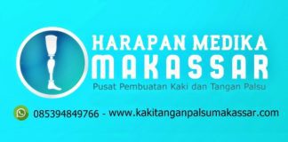 MENGENAL MANFAAT DAN PERBEDAAN KAKI PALSU DAN TANGAN PALSU