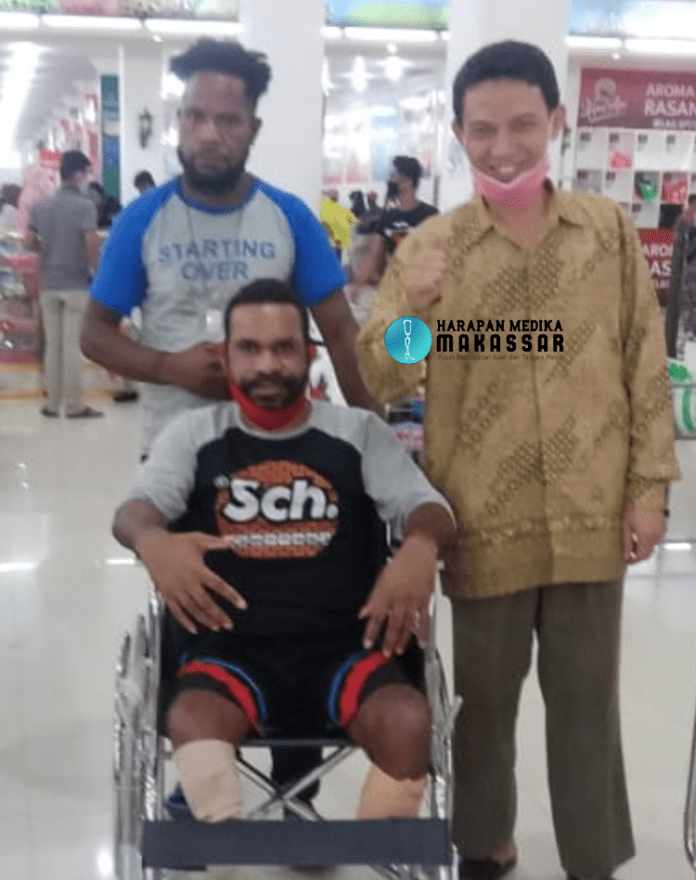 KISAH INSPIRATIF PASIEN AMPUTASI KAKI DI PAPUA