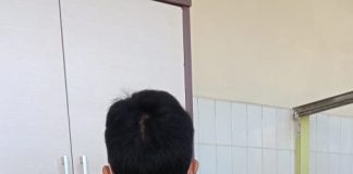 KETAHUI MANFAAT BRACE UNTUK PASIEN SCOLIOSIS KETAHUILAH MANFAAT BRACE UNTUK PASIEN SCOLIOSIS