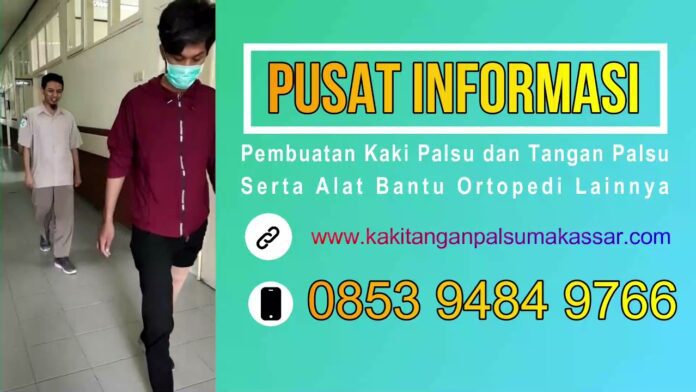 Harga Kaki Palsu