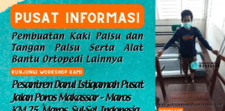 TIPS LATIHAN NAIK TURUN TANGGA BAGI PENGGUNA KAKI PALSU teknik dasar latihan bagi pengguna kaki palsu