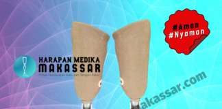 WOW… TERNYATA KAKI PALSU BISA DI BUAT LEBIH RINGAN Kaki Palsu Ringan Aman dan Nyaman