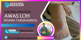 GAK MAU AMPUTASI? AWAS LOH NYAWA TARUHANNYA