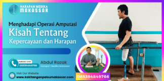 INILAH KISAHKU SAAT KAKI YANG KUSAYANGI HARUS BERPISAH DARI TUBUH