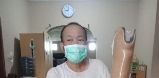 KOK BISA YACH SOKET KAKI PALSU MENJADI LONGGAR?