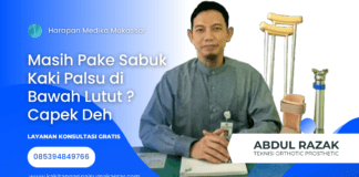 MASIH PAKE SABUK KAKI PALSU BAWAH LUTUT?CAPEK DEH