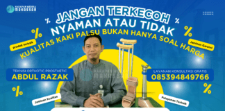 Jangan Terkecoh, Nyaman atau Tidak, Kualitas Kaki Palsu Bukan Hanya Soal Harga Terobosan Kaki Palsu: Kenyamanan Tak Lagi Tergantung pada Harga!