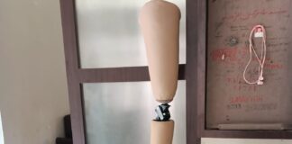 Tahukah Anda Kaki Palsu Atas Lutut? Mengembalikan Kemampuan Berjalan dan Beraktivitas Kaki palsu atas lutut bantu Anda kembali berjalan & beraktivitas! Pelajari fungsinya, cara memilih, & tips perawatan. Tingkatkan mobilitas & kemandirian Anda.