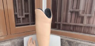 Pakai Kaki Palsu: Jangan Terburu-buru, Ikuti Saran Dokter dan Teknisi! Tips Menunggu Kaki Palsu dengan Aman dan Nyaman