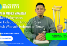 Harapan Medika Makassar: Solusi Kaki & Tangan Palsu Terpercaya di Indonesia Timur Harapan Medika Makassar: Solusi Kaki & Tangan Palsu Indonesia Timur