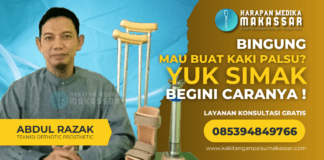 Bingung Mau Membuat Kaki Palsu? Yuk Simak, Begini Caranya! Bingung Mau Membuat Kaki Palsu? Yuk Simak, Begini Caranya!