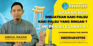 Cara Membuat Kaki Palsu yang Ringan dan Nyaman Dengan Harga Terjangkau Kaki Palsu Ringan: Solusi Terbaik untuk Pasien Amputasi di Indonesia
