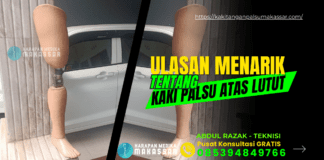 Kaki Palsu Tepat Lutut : Apakah Hanya Untuk Pasien Amputasi di Bagian Lutut ? Belaja Tentang Kaki Palsu Tepat Lutut, GRATIS Konsultasi Kaki Palsu