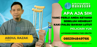 Apa yang Perlu Anda Ketahui Sebelum Membuat Kaki Palsu Bawah Lutut? Tahukah Anda? Salah memilih waktu pengukuran kaki palsu bisa membuatnya tidak nyaman. Simak tipsnya di sini!