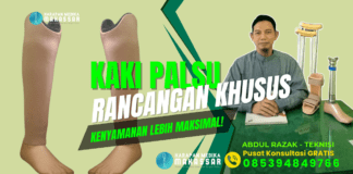 PERLUKAH PAKAI SABUK UNTUK KAKI PALSU BAWAH LUTUT? Kaki palsu tanpa sabuk, lebih nyaman untuk aktivitas harian! Melangkah stabil tanpa ribet, solusi modern untuk amputasi bawah lutut! Bebas bergerak, kaki palsu bawah lutut terbaik untuk Anda! Hidup baru dimulai dengan langkah yang lebih percaya diri! Rasakan teknologi kaki palsu modern, nyaman dan simpel digunakan! Prostetik tanpa sabuk, langkah ringan untuk hari yang ceria! Solusi prostetik canggih, mobilitas maksimal tanpa batas! Desain inovatif, nyaman dipakai, cocok untuk kebutuhan Anda! Langkah pasti, nyaman, dan stabil dengan kaki palsu modern! Kembali aktif dengan kaki palsu yang dirancang khusus untuk Anda!
