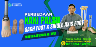 APA SIH BEDANYA KAKI PALSU TIPE SACH FOOT DAN SINGLE AXIS FOOT? Cocok untuk Aktivitas Berat! Ini Dia Perbedaan Kaki Palsu SACH Foot dan Single Axis Foot yang Wajib Diketahui