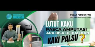 Kaki Palsu dan Kekakuan Lutut: Cara Mudah Mengatasinya yang Tak Banyak Orang Tahu! Kaki Palsu dan Kekakuan Lutut: Cara Mudah Mengatasinya yang Tak Banyak Orang Tahu!