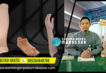 Layanan Pembuatan Kaki Palsu dan Tangan Palsu di Palu dan Gorontalo dari Harapan Medika Makassar Pembuatan Kaki Palsu dan Tangan Palsu di Palu Gorontalo