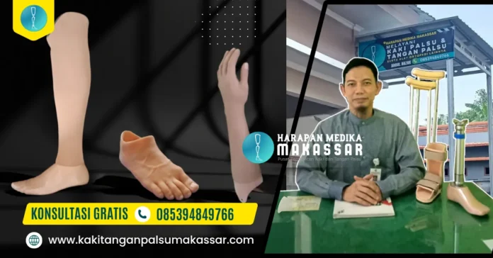 Pembuatan-Kaki-Palsu-dan-Tangan-Palsu-di-Palu-Gorontalo Pembuatan Kaki Palsu dan Tangan Palsu di Palu Gorontalo