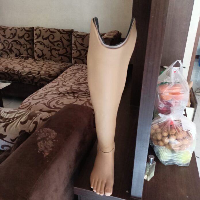 Lutut Kaku Pasca Amputasi? Ini Solusi Tepat Pakai Kaki Palsu Mengalami lutut kaku pasca amputasi? Kenali penyebab, risiko luka, dan solusi latihan agar Anda sukses memakai kaki palsu bawah lutut.