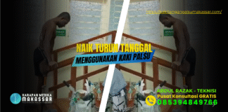 TEKNIK BERJALAN MEMAKAI KAKI PALSU SAAT NAIK TURUN TANGGA DAN TANJAKAN Teknik Berjalan Kaki Palsu Naik Turun Tangga