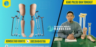 APA BENAR, PASIEN PAKE KAKI PALSU WAJIB LEPAS TONGKAT? Ini Penjelasannya Kaki Palsu dan Tongkat