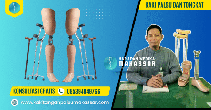 kaki-palsu-tongkat-wajib-lepas Kaki Palsu dan Tongkat