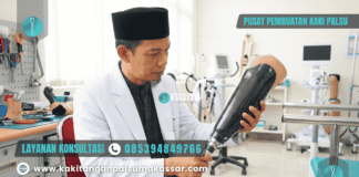 Solusi Tepat Soket Kaki Palsu Bawah Lutut Longgar Teknisi pria memeriksa soket kaki palsu bawah lutut longgar