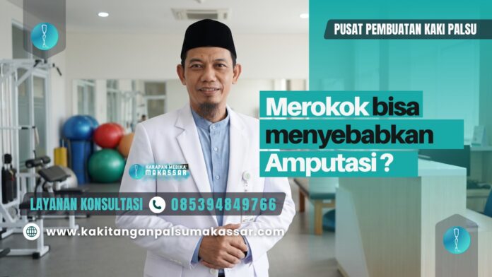 Apakah merokok menyebabkan amputasi kaki merokok menyebabkan amputasi kaki