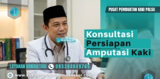 Ketika Kaki Diamputasi: Alasan, Proses, dan Rehabilitasi Dokter pria profesional memberikan konsultasi medis mengenai prosedur amputasi kaki di ruangan rumah sakit