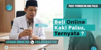 Resiko Membeli Kaki Palsu Via Online Sesi konsultasi tatap muka antara teknisi prostetik dan pasien amputasi sebelum proses pembuatan kaki palsu