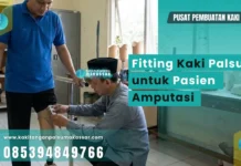 Kaki Palsu Pasien Diabetes? Jangan Terburu-buru! Teknisi melakukan fitting kaki palsu pada pasien amputasi
