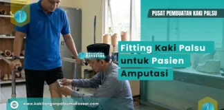 Kaki Palsu Pasien Diabetes? Jangan Terburu-buru! Teknisi melakukan fitting kaki palsu pada pasien amputasi