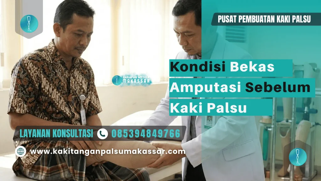 Pemeriksaan kondisi bekas amputasi sebelum menggunakan kaki palsu