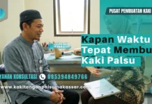 Waktu Tepat Membuat Kaki Palsu Pasien Diabetes Pasien amputasi diabetes berkonsultasi tentang persiapan kaki palsu