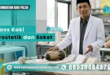 Soket Kaki Palsu Bawah Lutut Longgar: Penyebab dan Solusi Kaos kaki prostetik untuk penyesuaian ruang pada soket kaki palsu